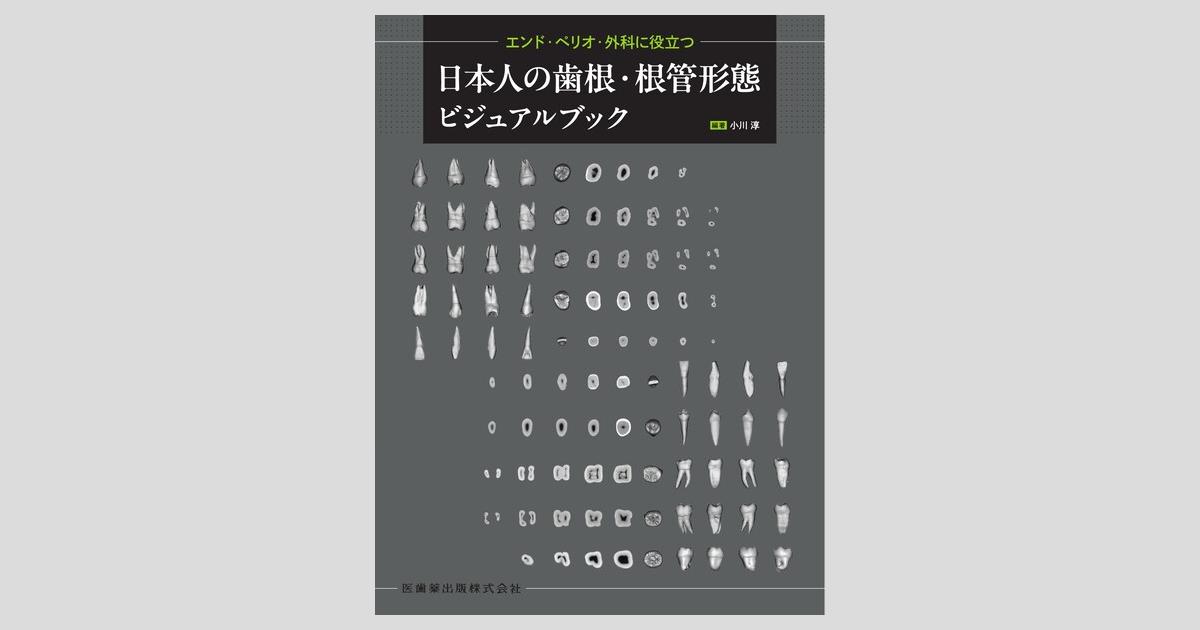 エンド・ペリオ・外科に役立つ 日本人の歯根・根管形態ビジュアルブック エンド・ペリオ・外科に役立つ 日本人の歯根・根管形態