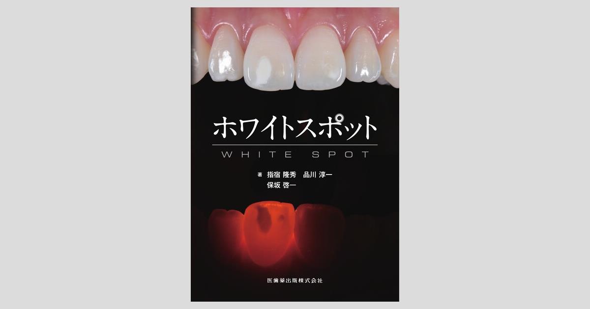 ホワイトスポット※裁断済み 大阪のホワイトスポット治療｜削らず1日でシミが消えるアイコン