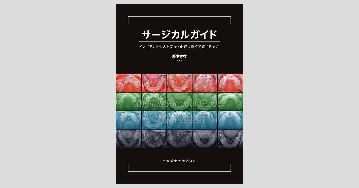 サージカルガイド インプラント埋入を安全・正確に導く実践ステップ