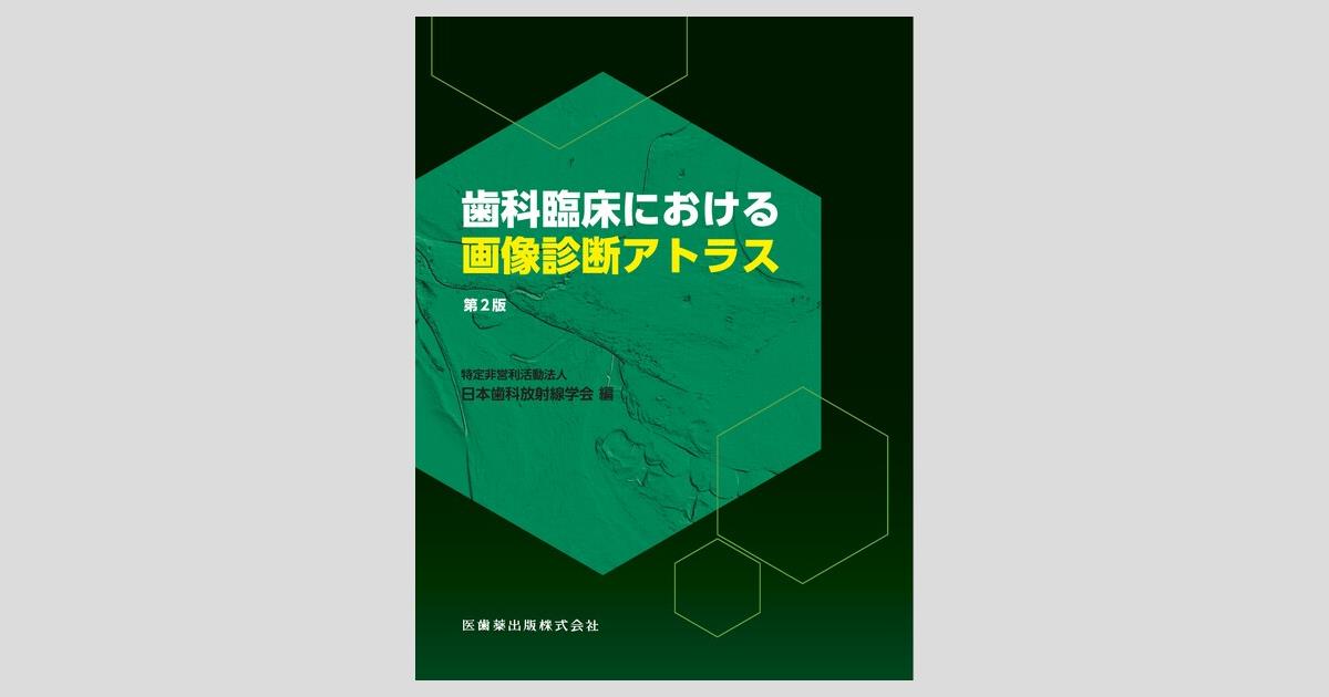 A11922531]歯科臨床における画像診断アトラス 第2版-