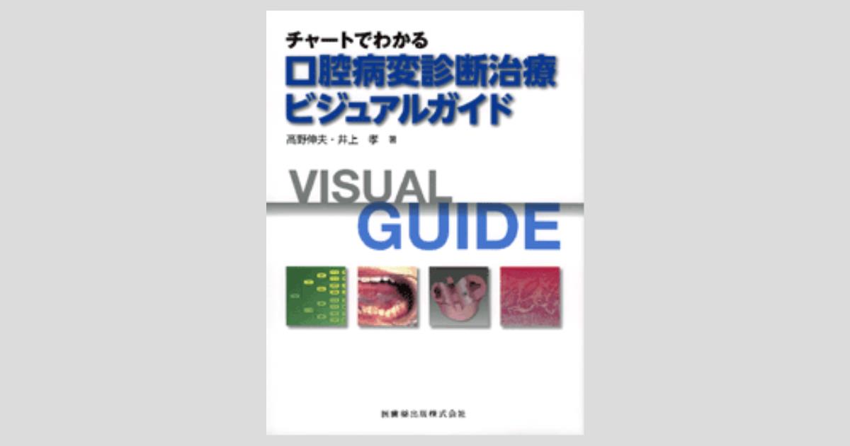 チャートでわかる 口腔病変診断治療ビジュアルガイド/医歯薬出版株式会社