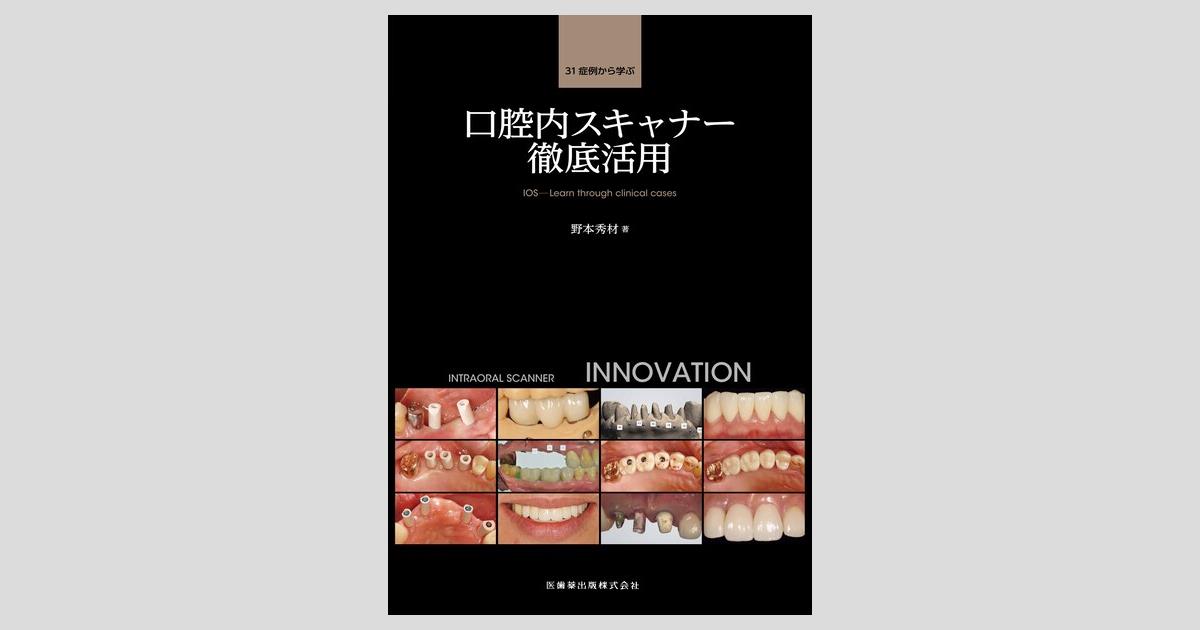 31症例から学ぶ口腔内スキャナー徹底活用 野本 秀材 31症例から学ぶ口腔内スキャナー徹底活用 | 野本 秀材 |本