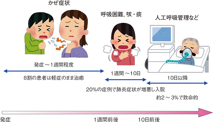 図1 新型コロナウイルス感染症の典型的な経過